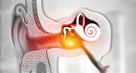 barotrauma wiki|Middle ear barotrauma .